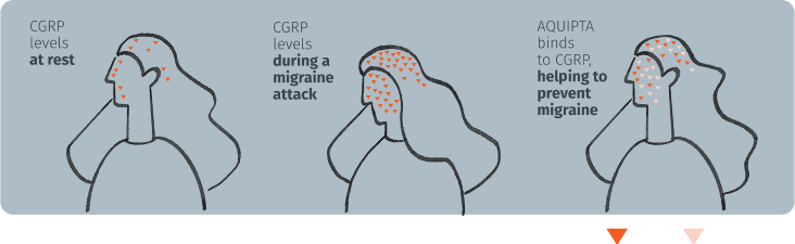 Infographic of CGRP levels at rest, during a migraine attack, and how Aquipta binds to CGRP, helping to prevent migraine