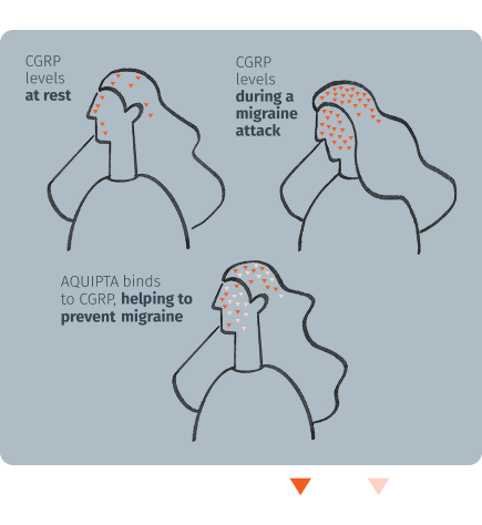 Infographic of CGRP levels at rest, during a migraine attack, and how Aquipta binds to CGRP, helping to prevent migraine
